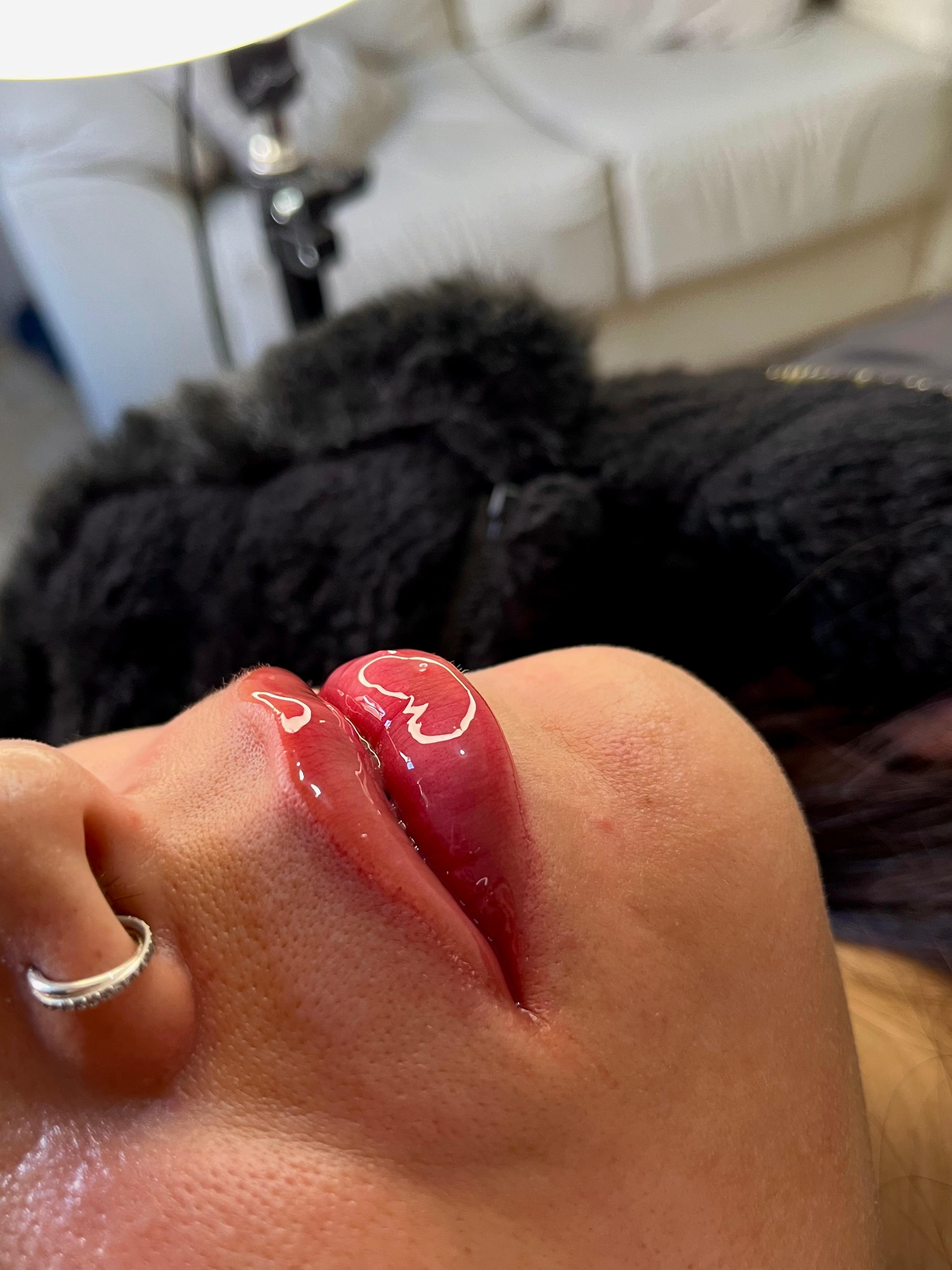 Resultado de tratamento labial no Nessa Beauty Studio